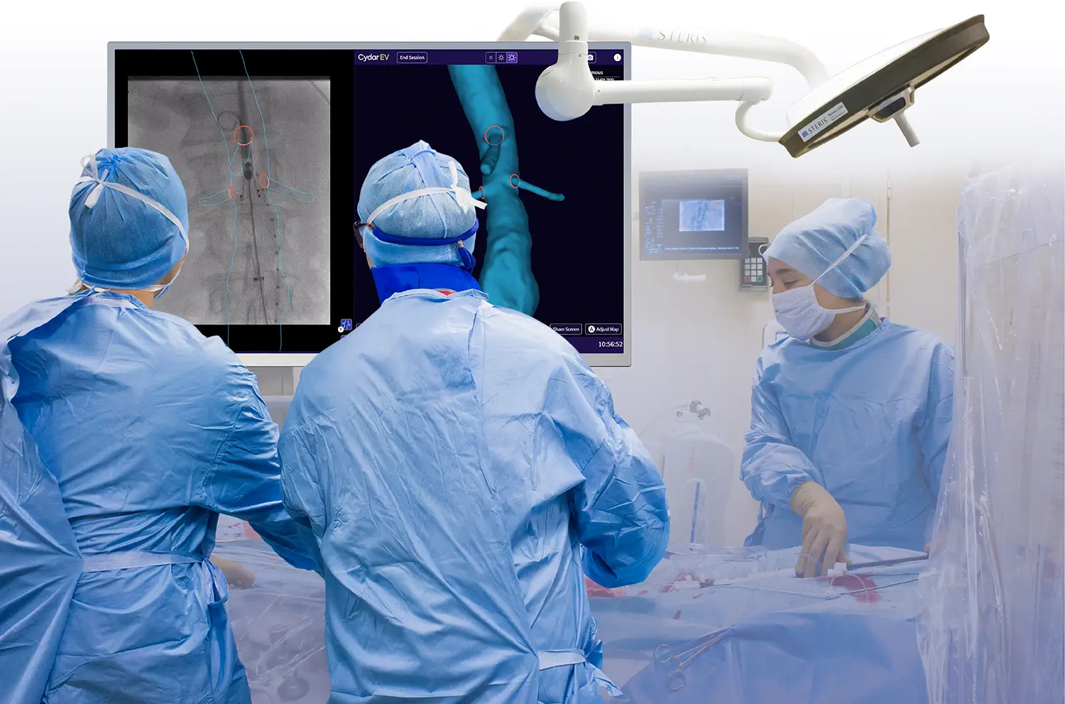 Doctors in front of screen aortic surgery