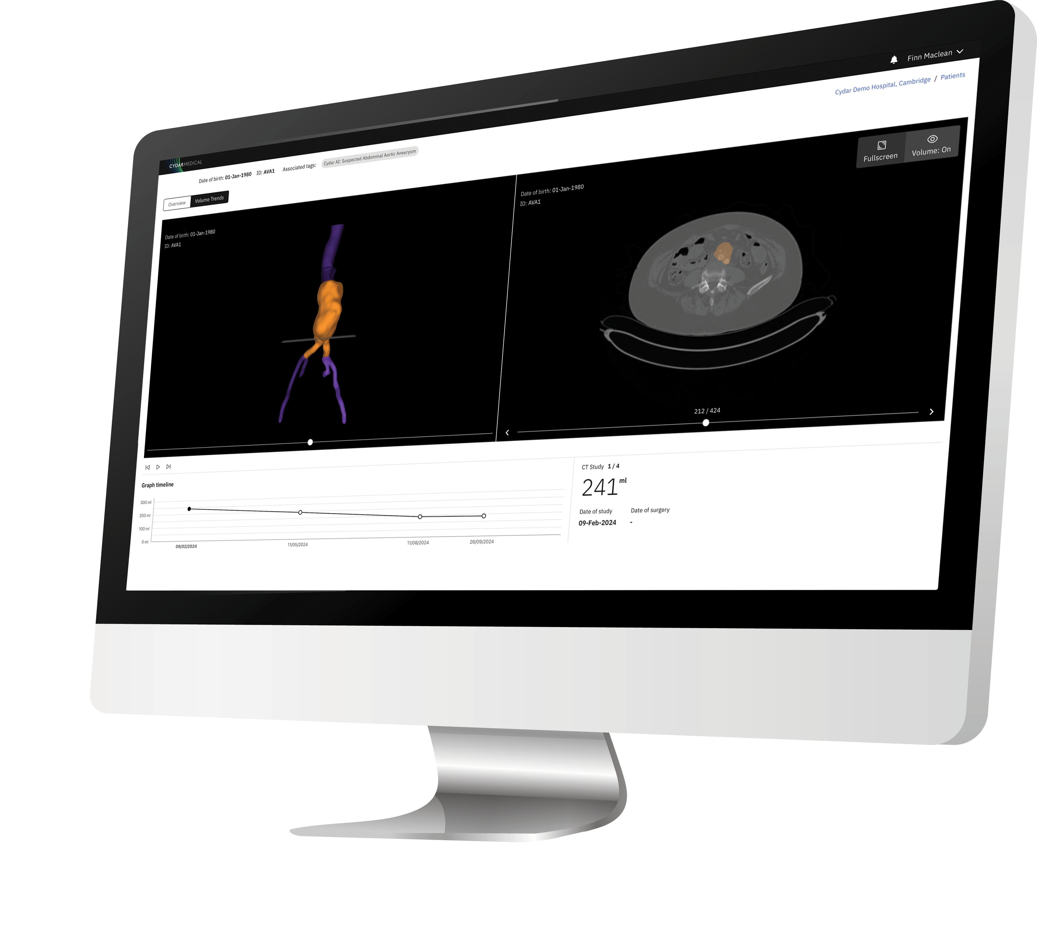 Ava Monitor Right Ava Monitor Right